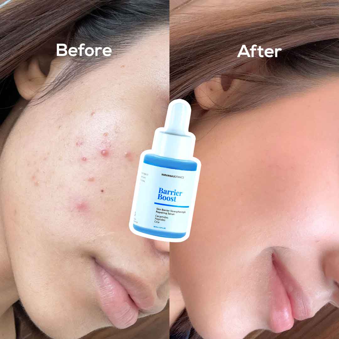 Barrier Serum - Before After