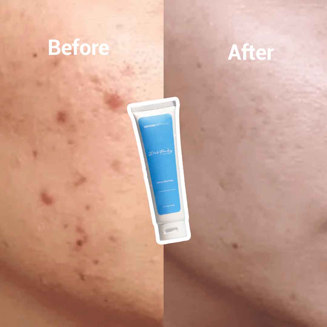 Cleanser - Before After