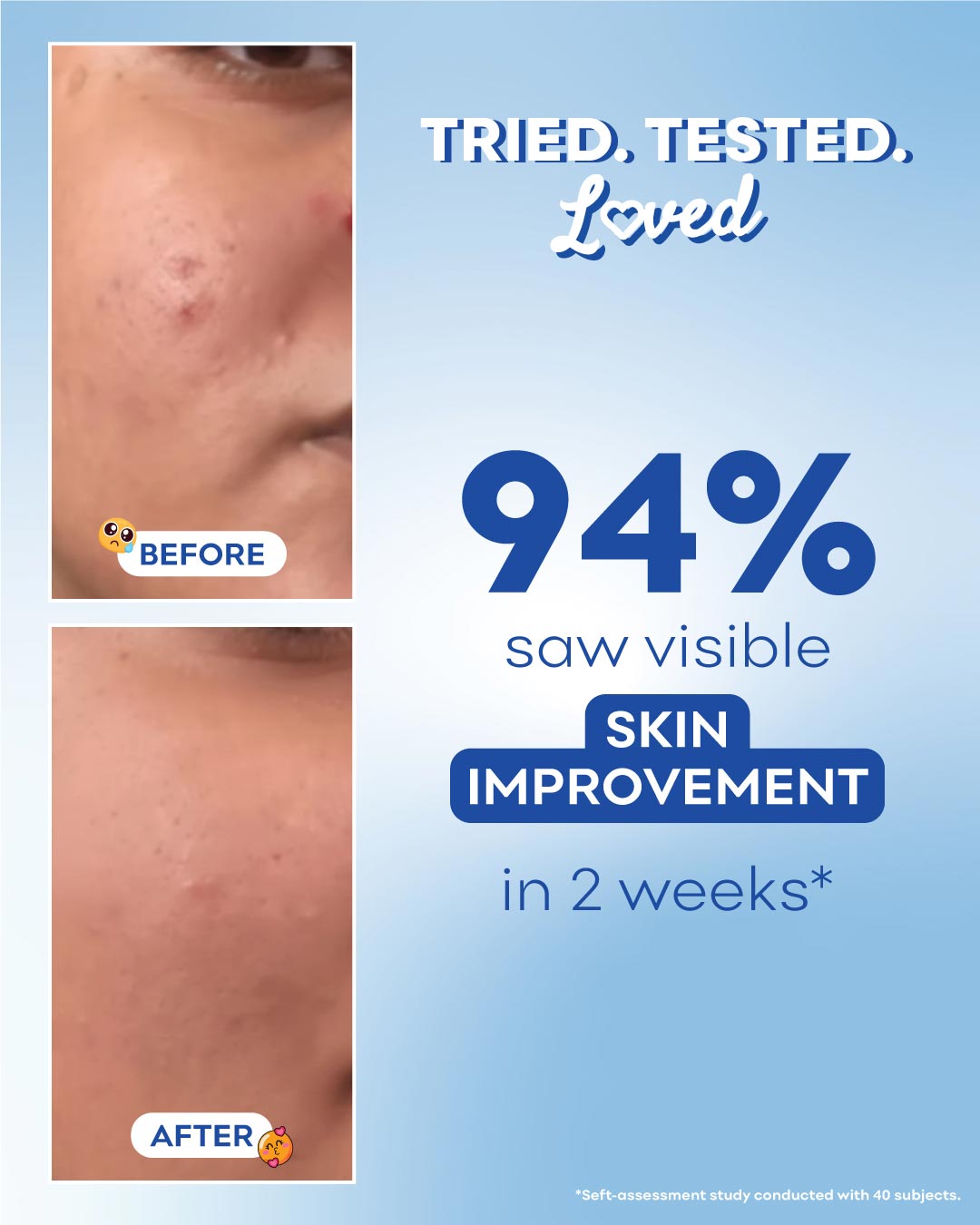 Before and after skin improvement results with a blue gradient background and text indicating 94% improvement in 2 weeks.