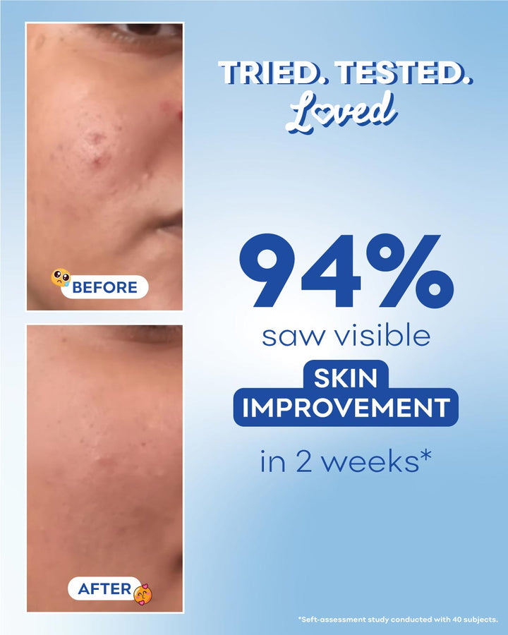 Before and after skin improvement results with a blue gradient background and text indicating 94% improvement in 2 weeks.