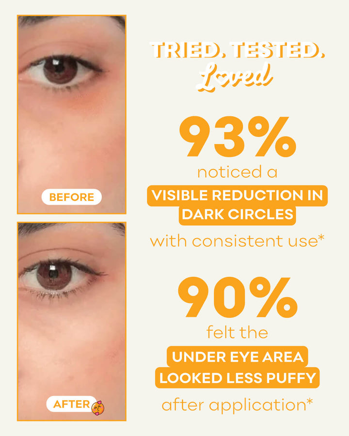 Bright-C Under Eye Cream for Dark Circles & Puffiness
