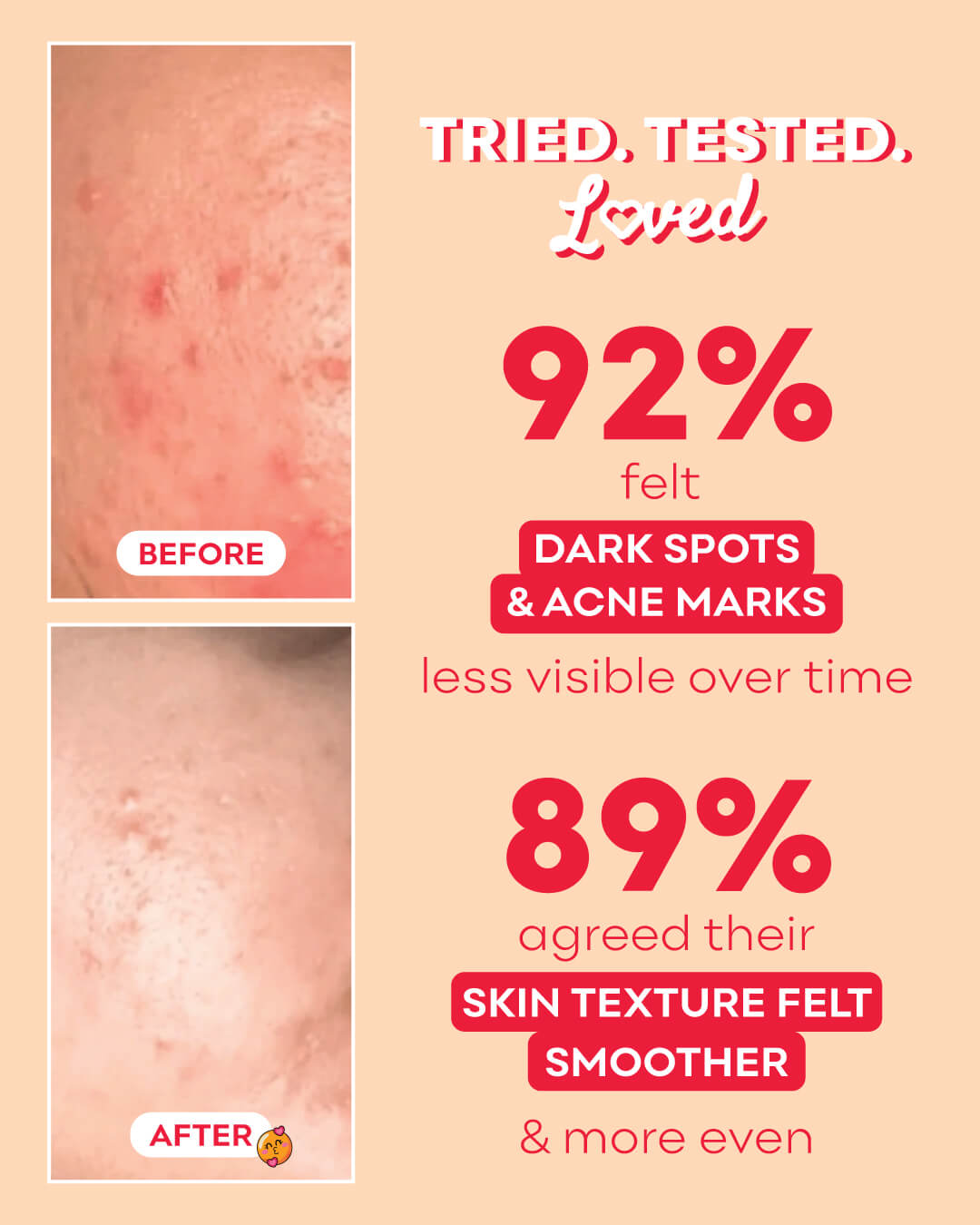 Vitamin C & E Serum