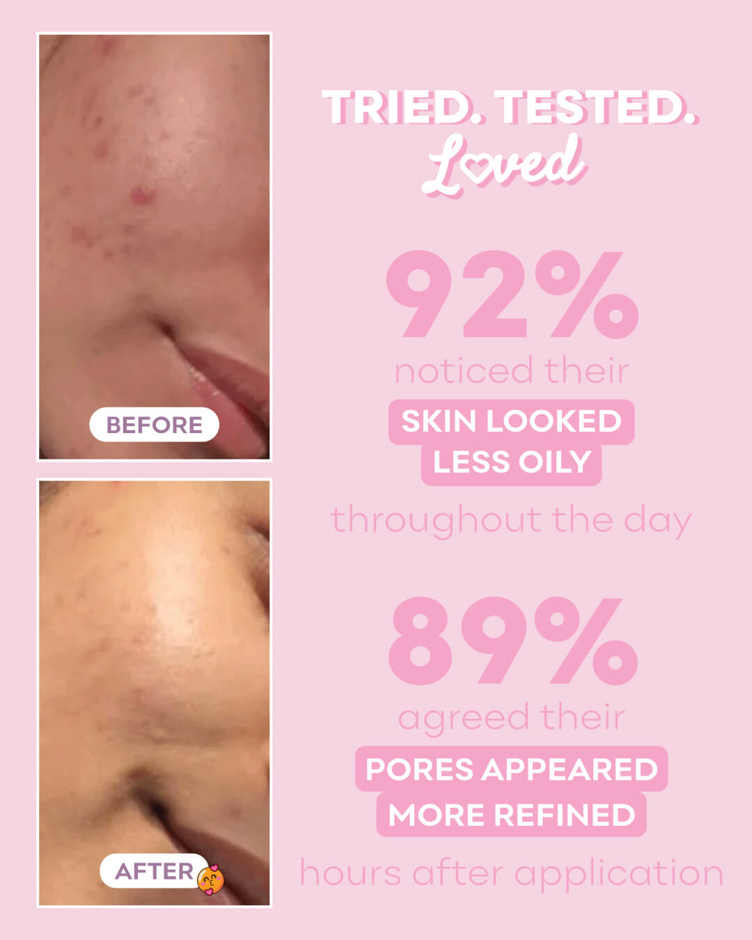 Cloud Oil Free Gel Moisturizer
