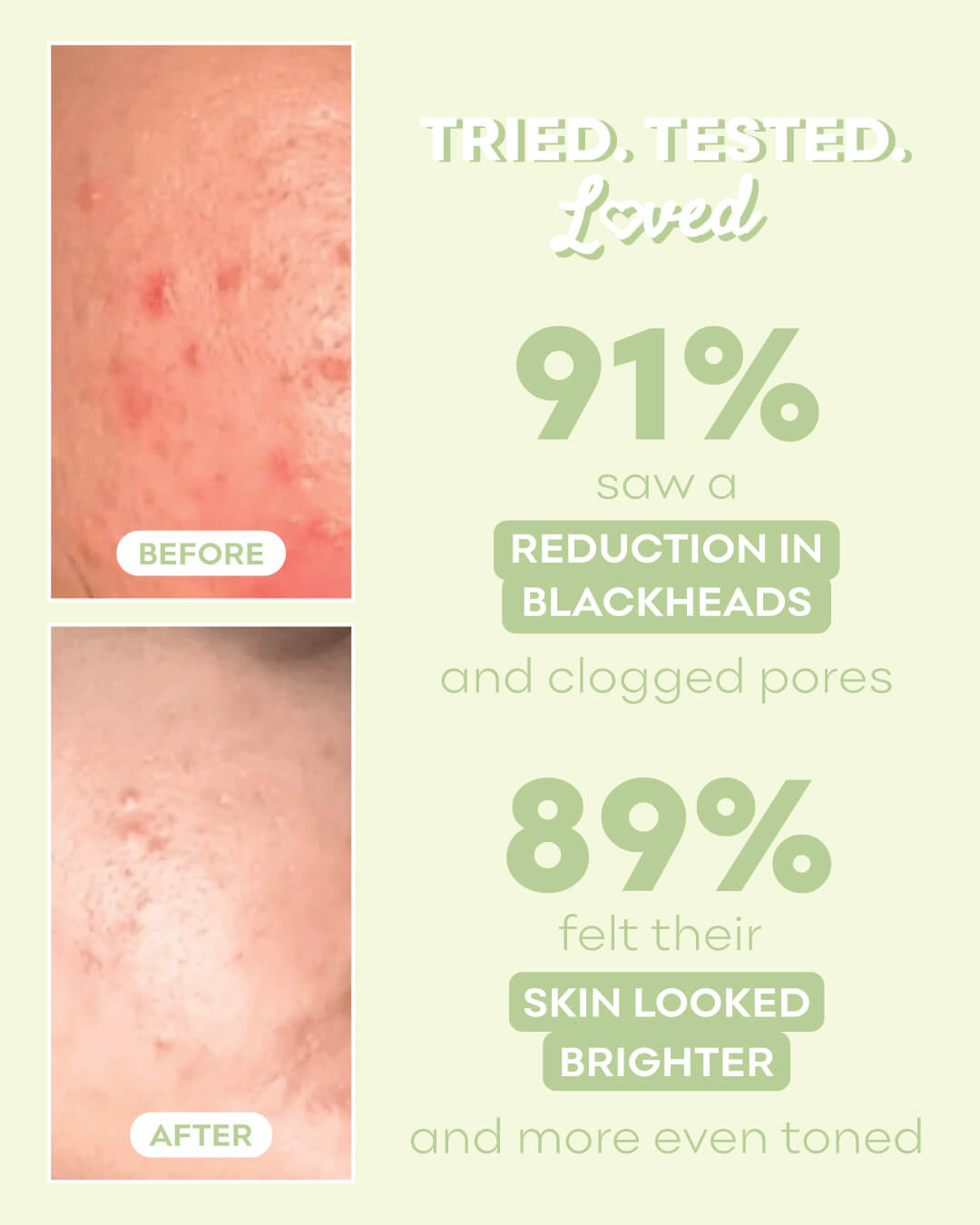 AHA BHA Exfoliating Treatment