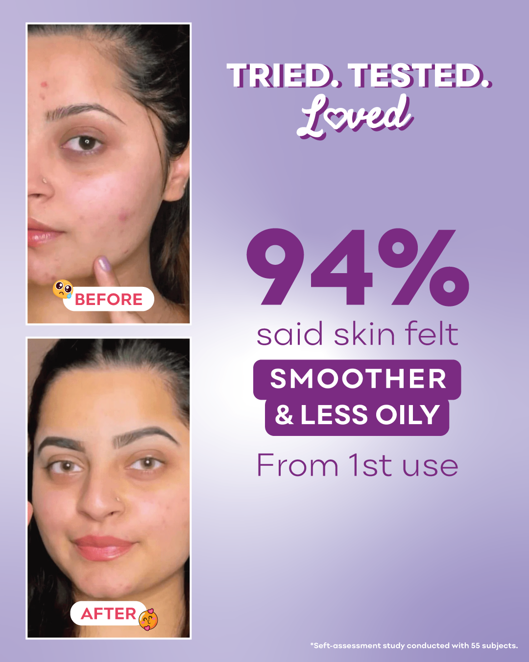 Before and after skin comparison with text on a purple background