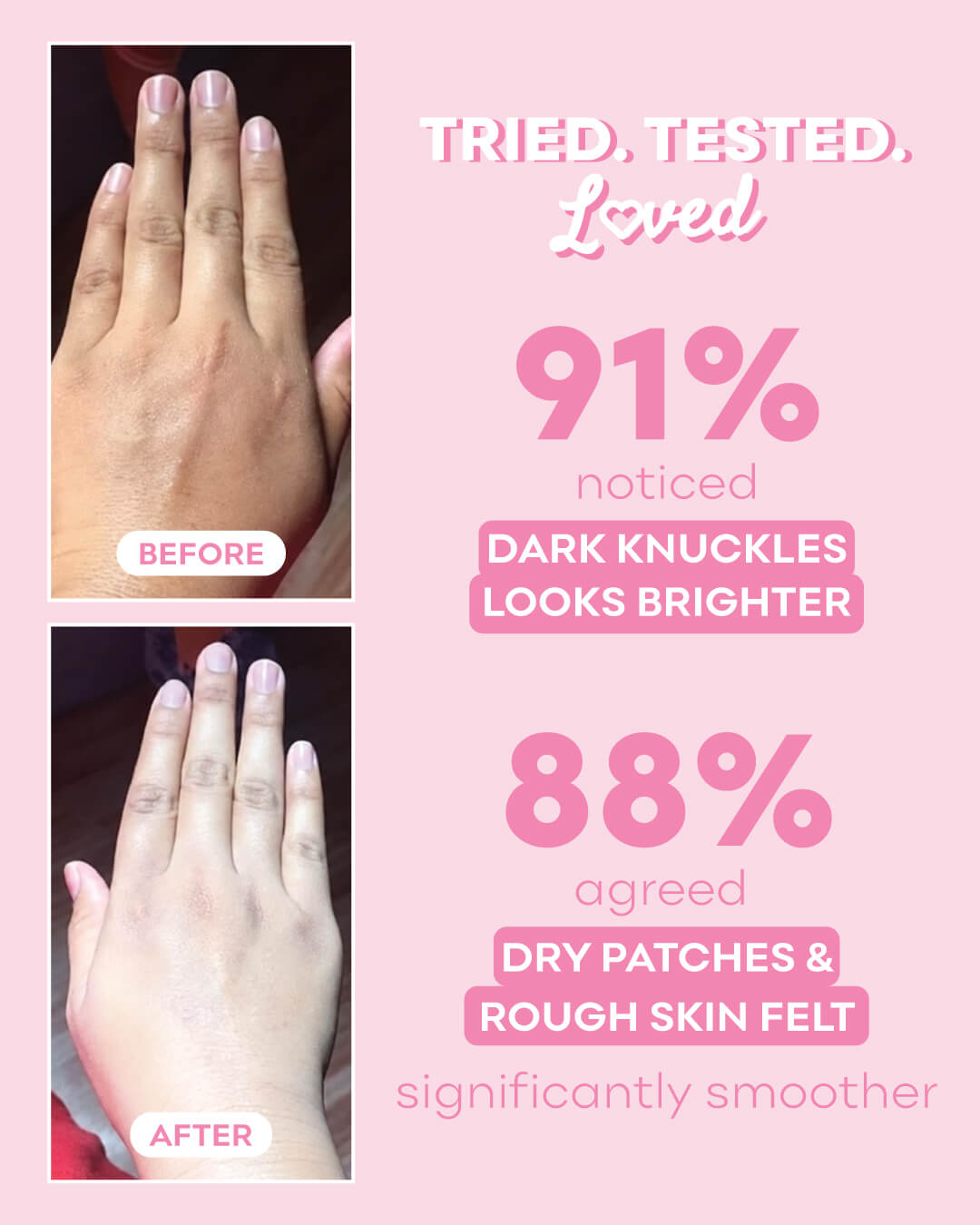 Hands & Feet Repair Brightening Cream