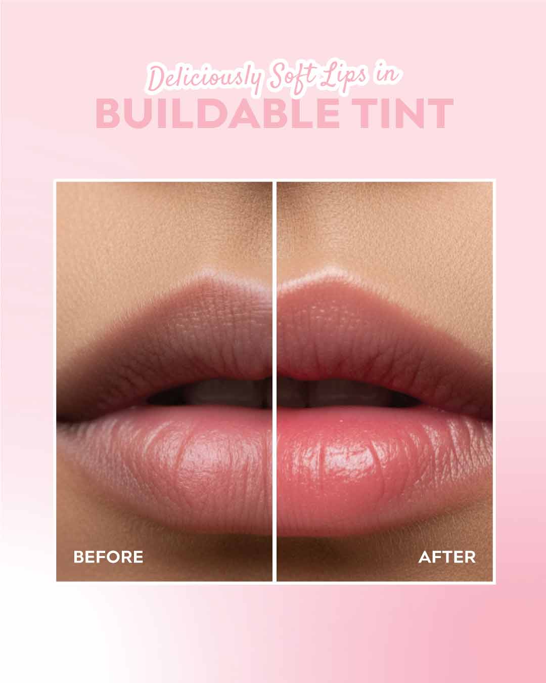 Lychee Sparkle - Lip Treatment - Repair Pigmented Dry Lips 🍧