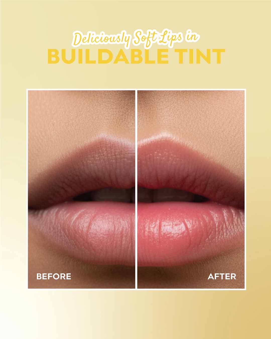 Mango Gelato - Lip Treatment -  Repair Pigmented Dry Lips 🥭