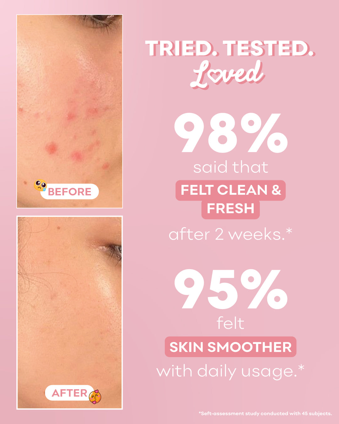 Mandelic Refresh Gel Cleanser