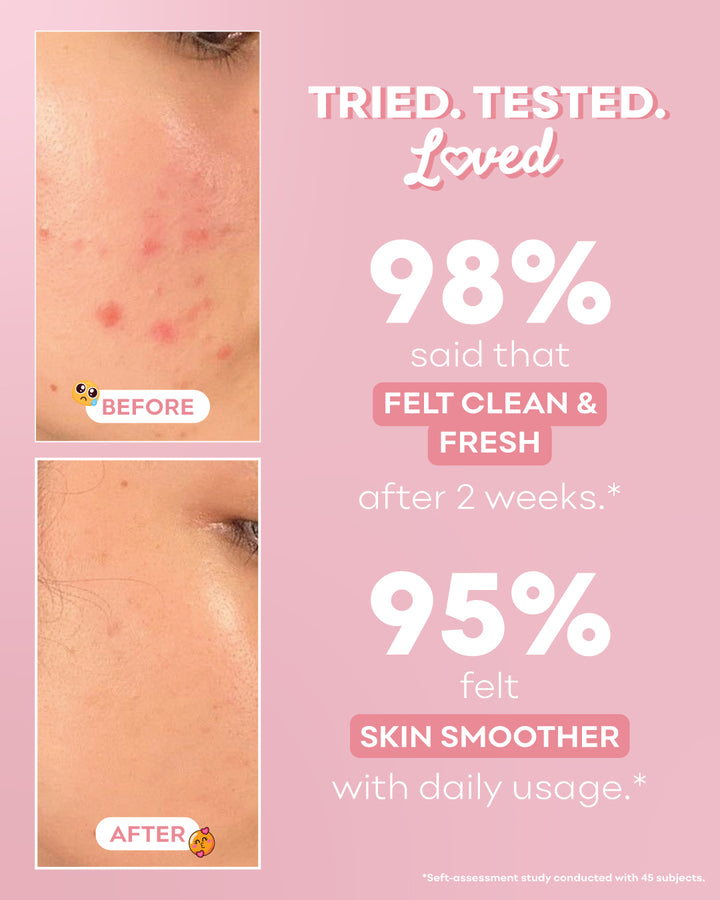Mandelic Refresh Gel Cleanser