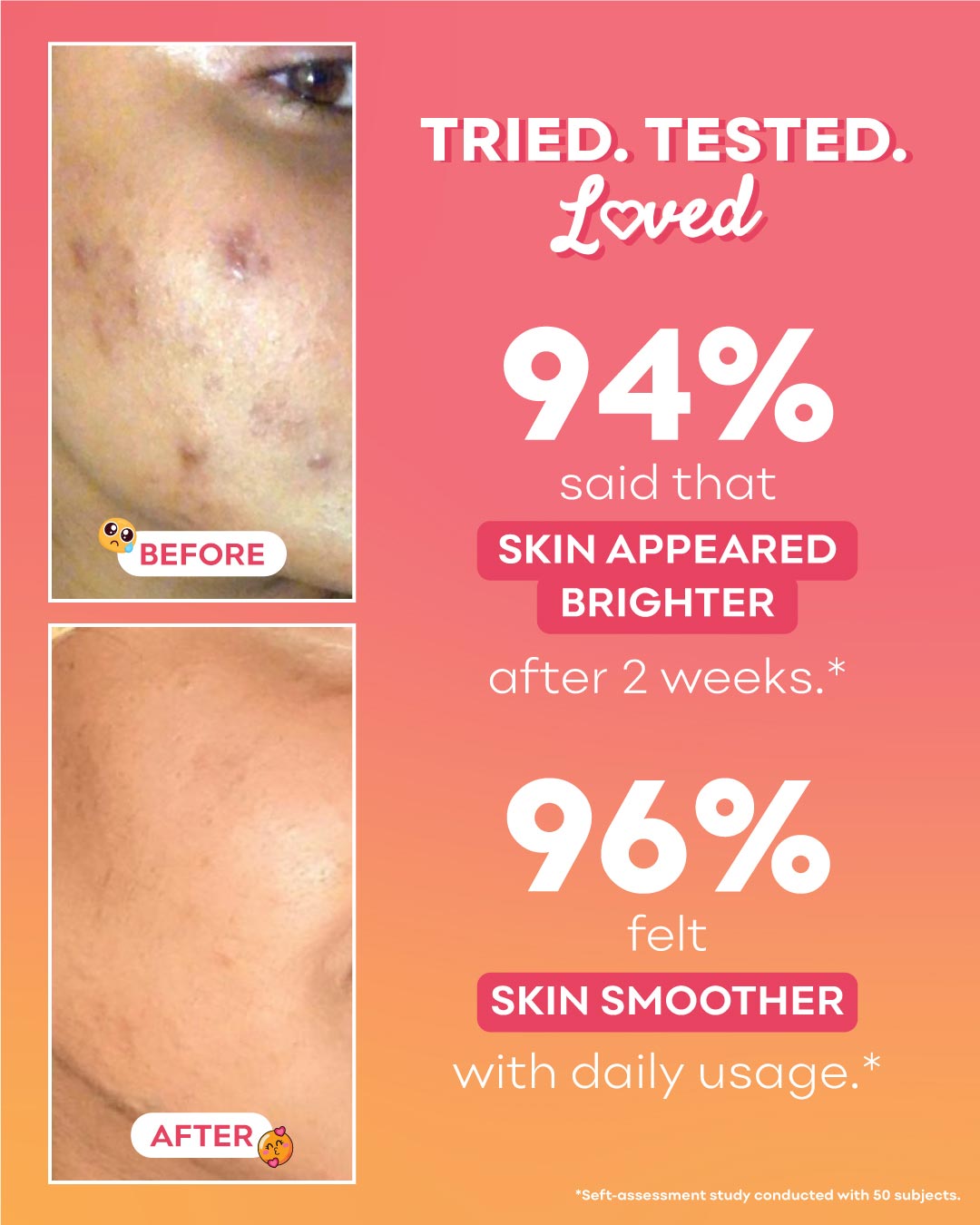 Peachcinamide TXA Serum (6% Niacinamide, 4% TXA) 🍑