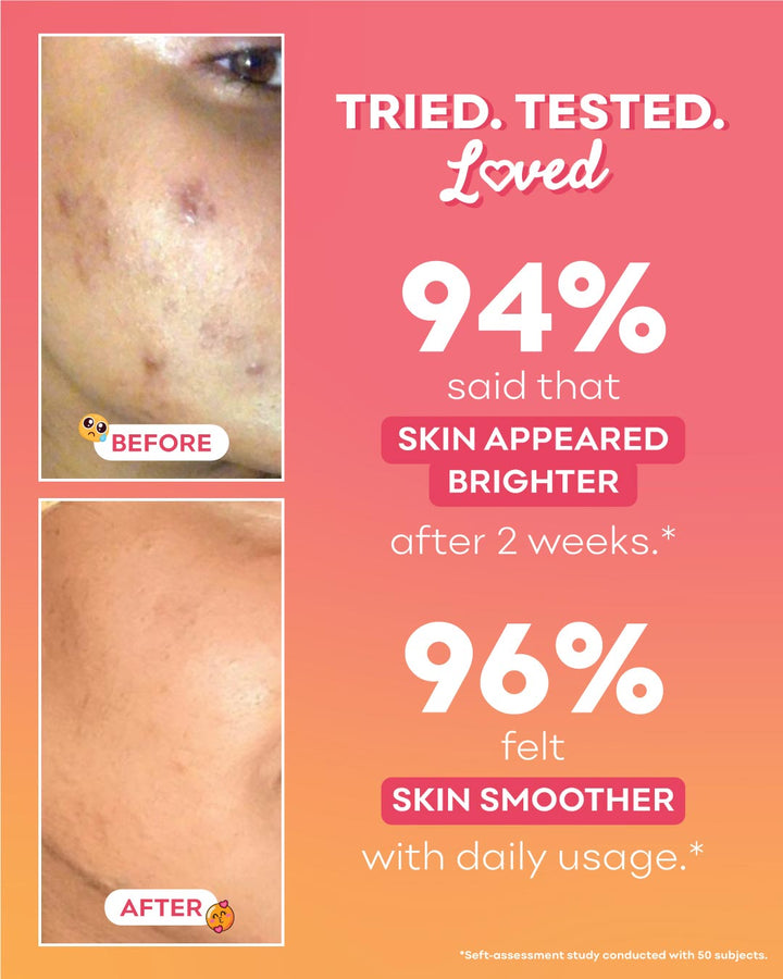 Peachcinamide TXA Serum (6% Niacinamide, 4% TXA) 🍑