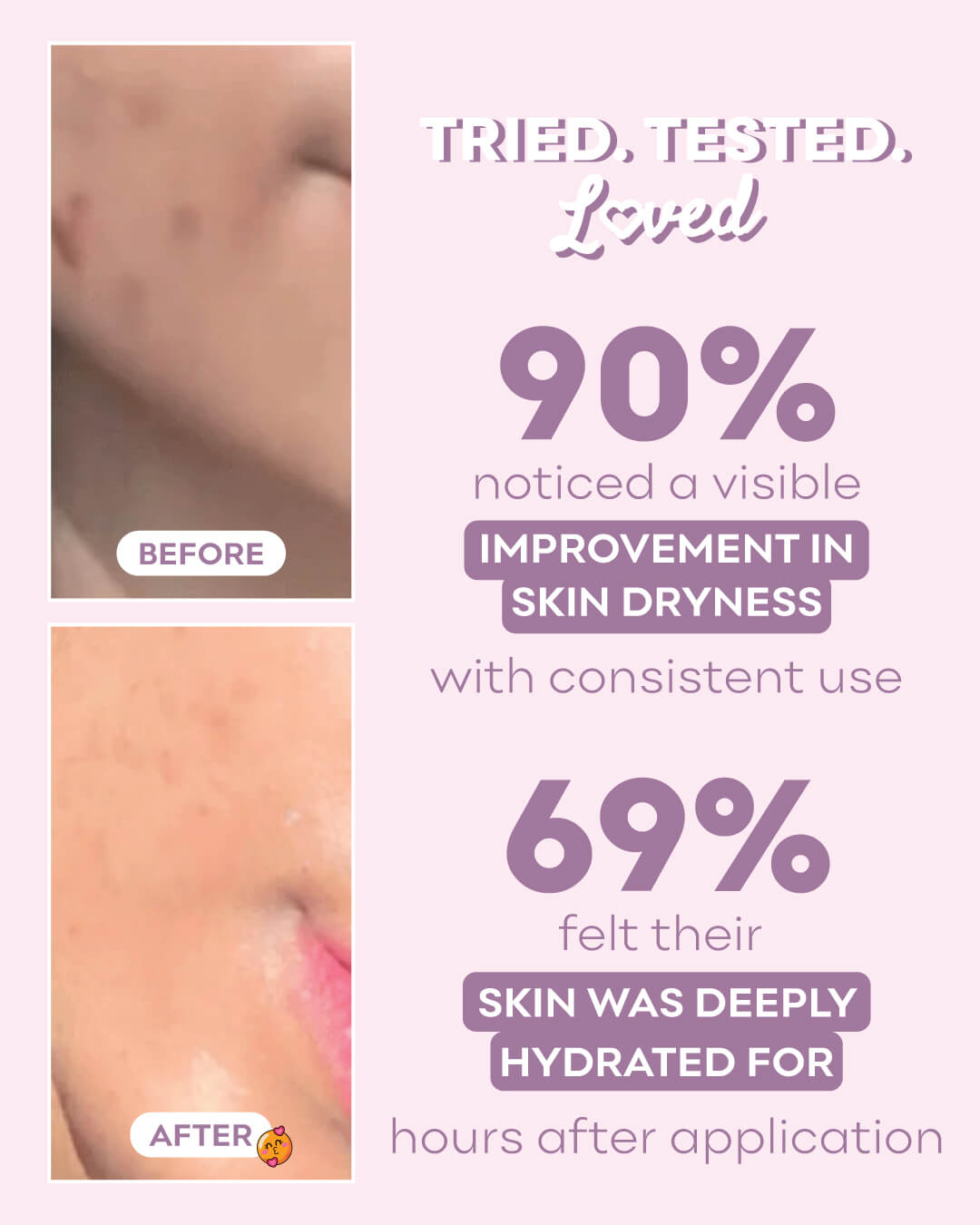 Whipped Moisturizer Cream