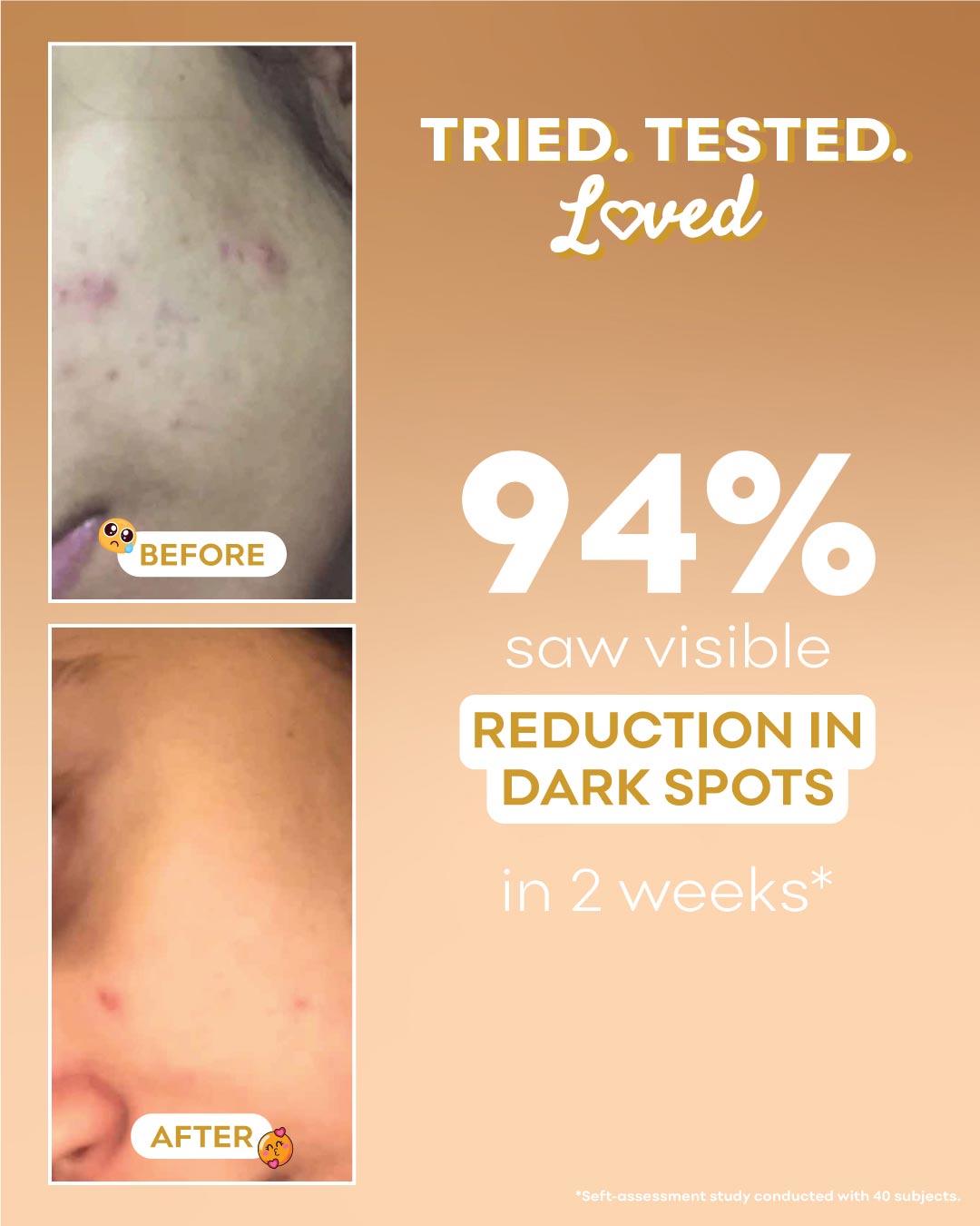 Before and after skin treatment results with text indicating 94% reduction in dark spots.